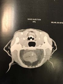 cerveau 1